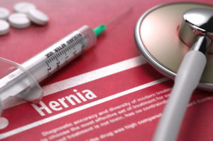 ventralex hernia mesh causes complications, says lawsuit