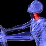 An infrared image showing the effects of a car accident on the neck.